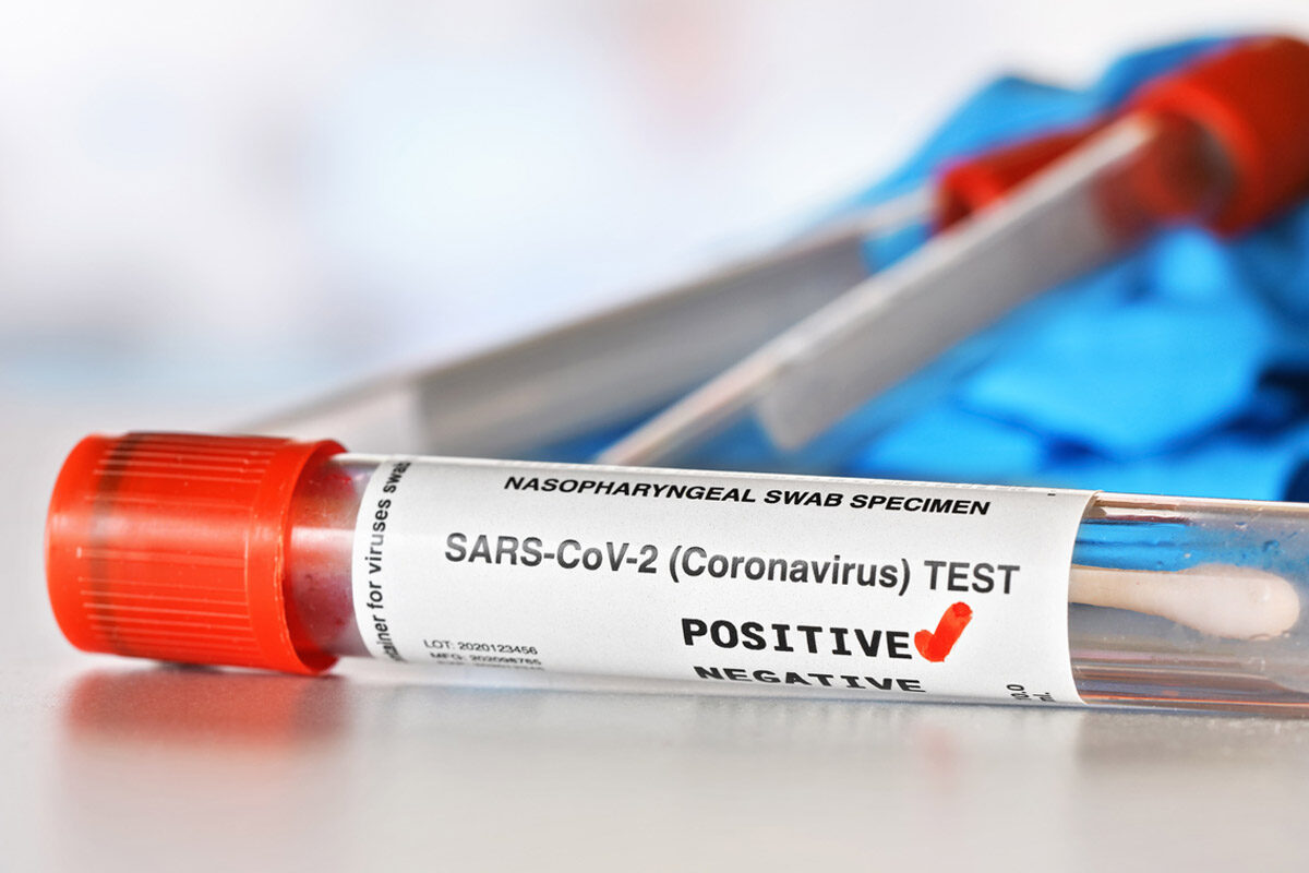 "COVID-19 Panic: Assam Worried Over 28-Year-Old Female Infected with JN.1 Subvariant of Omicron Virus" 3 Assam Worried Over 28-Year-Old Female Infected with JN.1 Subvariant of Omicron Virus"