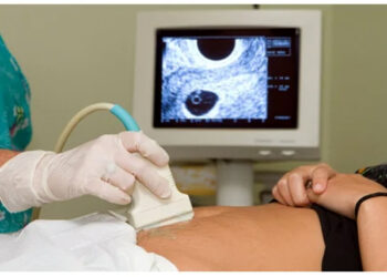 Fetus in fetu : আচৰিত ঘটনাত স্তম্ভিত চিকিৎসক, ভ্ৰূণৰ ভিতৰত ধৰা পৰিল ভ্ৰূণ 10 Fetus in fetu : আচৰিত ঘটনাত স্তম্ভিত চিকিৎসক, ভ্ৰূণৰ ভিতৰত ধৰা পৰিল ভ্ৰূণ